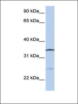 Anti-OCIAD1 antibody produced in rabbit affinity isolated antibody