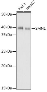 Anti-SMN1 Antibody, clone 9N9Q6, Rabbit Monoclonal