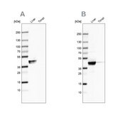 Anti-ACAT1 antibody produced in rabbit Ab1, Prestige Antibodies&#174; Powered by Atlas Antibodies, affinity isolated antibody, buffered aqueous glycerol solution