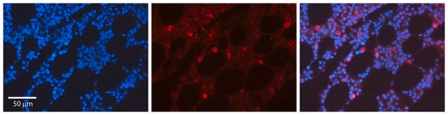 Anti-CDK6 antibody produced in rabbit IgG fraction of antiserum