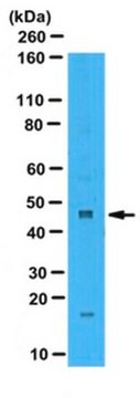 Anti-Zinc Finger Protein 260 Antibody serum, from rabbit