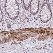 Anti-KCNN4 antibody produced in rabbit Prestige Antibodies&#174; Powered by Atlas Antibodies, affinity isolated antibody, buffered aqueous glycerol solution