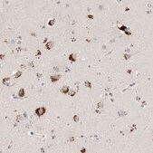 Anti-GGH antibody produced in rabbit Prestige Antibodies&#174; Powered by Atlas Antibodies, affinity isolated antibody, buffered aqueous glycerol solution