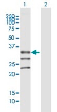 Anti-MOGAT1 antibody produced in mouse purified immunoglobulin, buffered aqueous solution