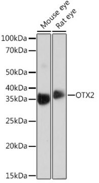 Anti-OTX2 Antibody, clone 6I3J0, Rabbit Monoclonal