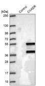 Anti-CXADR antibody produced in rabbit Prestige Antibodies&#174; Powered by Atlas Antibodies, affinity isolated antibody, buffered aqueous glycerol solution, ab2