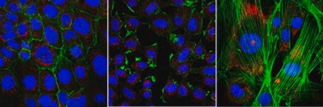 Anti-ARHGEF6 from rabbit, purified by affinity chromatography