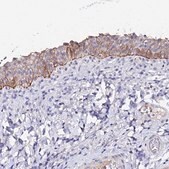 Anti-KRT17 antibody produced in rabbit Prestige Antibodies&#174; Powered by Atlas Antibodies, affinity isolated antibody, buffered aqueous glycerol solution