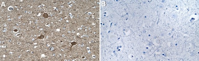 Anti-DCLK1-L Antibody, clone 1D16 ZooMAb&#174; Rabbit Monoclonal recombinant, expressed in HEK 293 cells