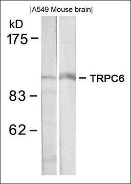 Anti-TRPC6 antibody produced in rabbit affinity isolated antibody