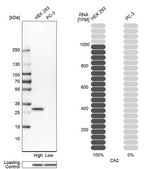 Anti-CA2 antibody produced in rabbit Prestige Antibodies&#174; Powered by Atlas Antibodies, affinity isolated antibody, buffered aqueous glycerol solution
