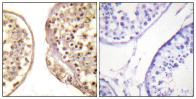 Anti-C-JUN antibody produced in rabbit affinity isolated antibody