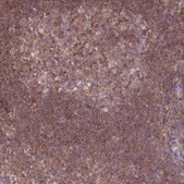 Anti-PRKAR1A antibody produced in rabbit Prestige Antibodies&#174; Powered by Atlas Antibodies, affinity isolated antibody, buffered aqueous glycerol solution