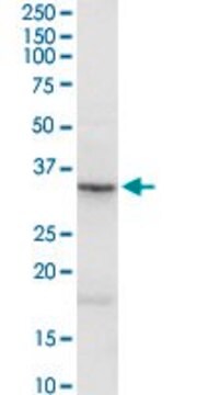 Anti-ASPN antibody produced in rabbit purified immunoglobulin, buffered aqueous solution