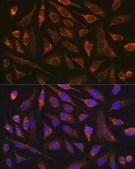 Anti-MMP13 antibody produced in rabbit