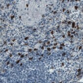 Monoclonal Anti-MMP9 antibody produced in mouse Prestige Antibodies&#174; Powered by Atlas Antibodies, clone CL0542, purified immunoglobulin, buffered aqueous glycerol solution