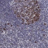 Anti-TYMS antibody produced in rabbit Prestige Antibodies&#174; Powered by Atlas Antibodies, affinity isolated antibody, buffered aqueous glycerol solution