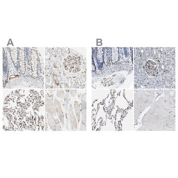 Anti-CD93 antibody produced in rabbit Prestige Antibodies&#174; Powered by Atlas Antibodies, affinity isolated antibody, buffered aqueous glycerol solution