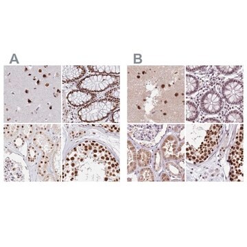 Anti-AKAP8L antibody produced in rabbit Prestige Antibodies&#174; Powered by Atlas Antibodies, affinity isolated antibody, buffered aqueous glycerol solution