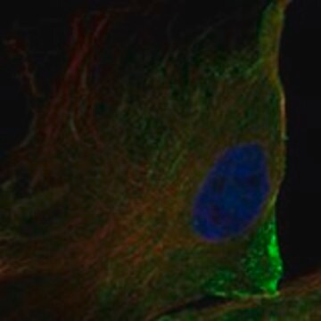 Anti-ANO10 antibody produced in rabbit Prestige Antibodies&#174; Powered by Atlas Antibodies, affinity isolated antibody, buffered aqueous glycerol solution