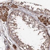 Anti-ASCC3 antibody produced in rabbit Prestige Antibodies&#174; Powered by Atlas Antibodies, affinity isolated antibody, buffered aqueous glycerol solution, ab2