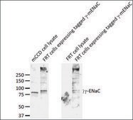 Anti-SCNN1G antibody produced in rabbit 1&#160;mg/mL, affinity isolated antibody