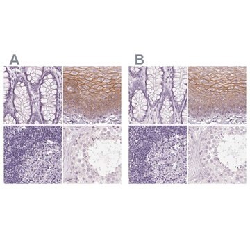 Anti-DSG3 antibody produced in rabbit Prestige Antibodies&#174; Powered by Atlas Antibodies, affinity isolated antibody, buffered aqueous glycerol solution