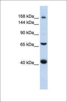 Anti-ABCC9 antibody produced in rabbit affinity isolated antibody