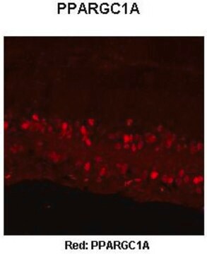 Anti-PPARGC1A affinity isolated antibody