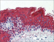 Anti-KRT1 antibody produced in rabbit affinity isolated antibody