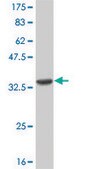 Monoclonal Anti-CNR2 antibody produced in mouse clone 3C7, purified immunoglobulin, buffered aqueous solution