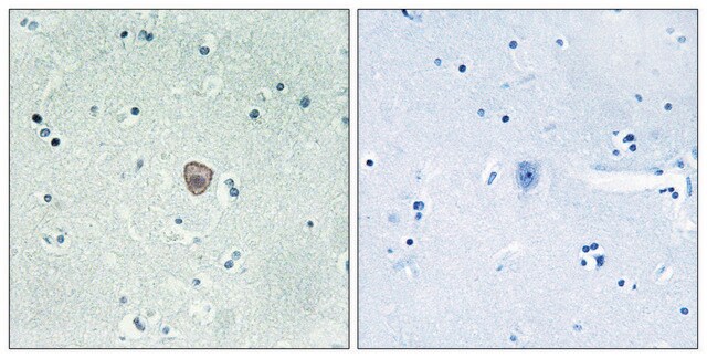 Anti-EDG8 antibody produced in rabbit affinity isolated antibody