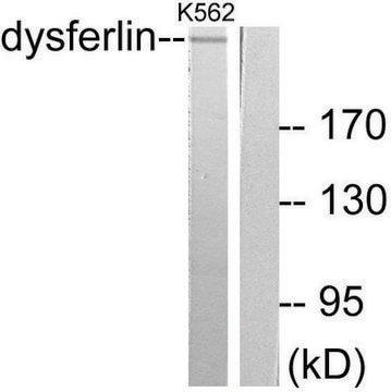 Anti-Dysferlin, antibody produced in rabbit affinity isolated antibody