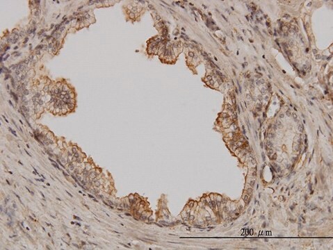 Monoclonal Anti-PAK1 antibody produced in mouse clone 1E11, purified immunoglobulin, buffered aqueous solution