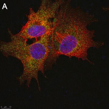 Anti-SLC19A1 Antibody, clone 2E11 ZooMAb&#174; Rabbit Monoclonal recombinant, expressed in HEK 293 cells