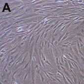 Human Mesenchymal Stem Cells (Bone Marrow) Human mesenchymal stem cells derived from bone marrow that have a capacity for expansion in vitro while maintaining their potential for differentiation to multiple lineages including adipocytes, osteoblasts and chondrocytes.