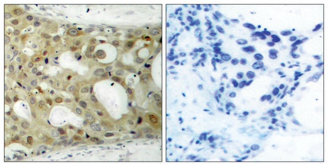 Anti-BCL-2 antibody produced in rabbit affinity isolated antibody