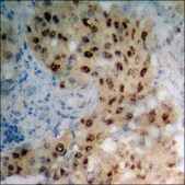Anti-phospho-p90 RSK (pThr573) antibody produced in rabbit affinity isolated antibody