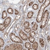 Anti-FOXRED2 antibody produced in rabbit Prestige Antibodies&#174; Powered by Atlas Antibodies, affinity isolated antibody, buffered aqueous glycerol solution, ab2