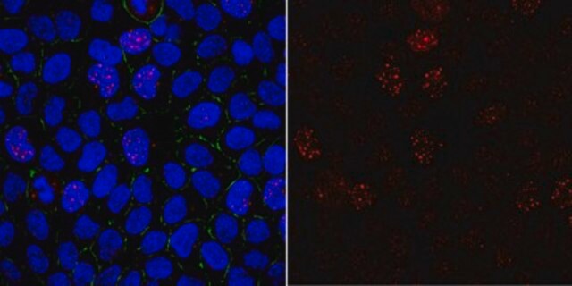 Anti-phospho Mis18-binding protein 1 (Thr702) Antibody from rabbit, purified by affinity chromatography