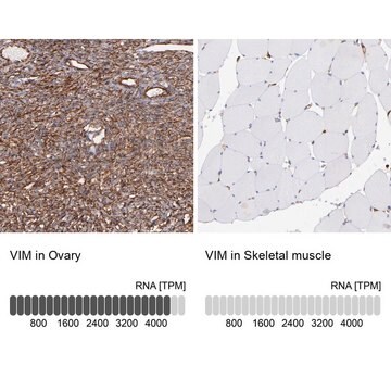 Anti-VIM antibody produced in rabbit Prestige Antibodies&#174; Powered by Atlas Antibodies, affinity isolated antibody, buffered aqueous glycerol solution