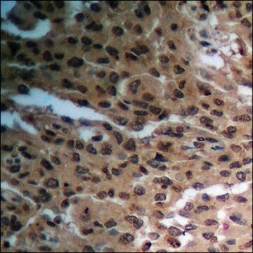 Anti-phospho-RAD52 (pTyr104) antibody produced in rabbit affinity isolated antibody