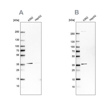 Anti-OTUD6B antibody produced in rabbit Prestige Antibodies&#174; Powered by Atlas Antibodies, affinity isolated antibody, buffered aqueous glycerol solution, Ab1