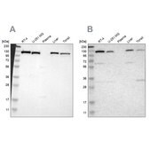 Anti-PITRM1 antibody produced in rabbit Ab2, Prestige Antibodies&#174; Powered by Atlas Antibodies, affinity isolated antibody, buffered aqueous glycerol solution