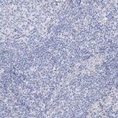Anti-GABRG1 antibody produced in rabbit Prestige Antibodies&#174; Powered by Atlas Antibodies, affinity isolated antibody, buffered aqueous glycerol solution