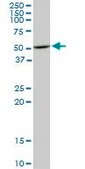 Monoclonal Anti-HDAC3 antibody produced in mouse clone 3E11, purified immunoglobulin, buffered aqueous solution