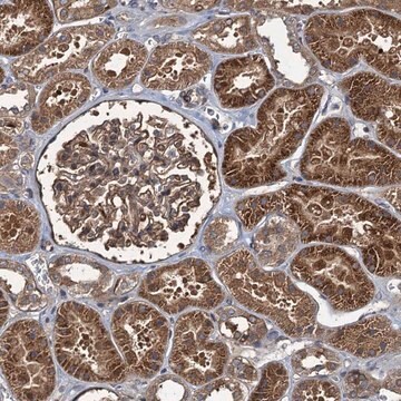 Anti-RHOBTB1 antibody produced in rabbit Prestige Antibodies&#174; Powered by Atlas Antibodies, affinity isolated antibody, buffered aqueous glycerol solution