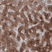 Monoclonal Anti-HMGCR antibody produced in mouse Prestige Antibodies&#174; Powered by Atlas Antibodies, clone CL0259, purified immunoglobulin, buffered aqueous glycerol solution