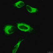 Anti-APP A4 Antibody, a.a. 66-81 of APP {NT}, clone 22C11 clone 22C11, Chemicon&#174;, from mouse