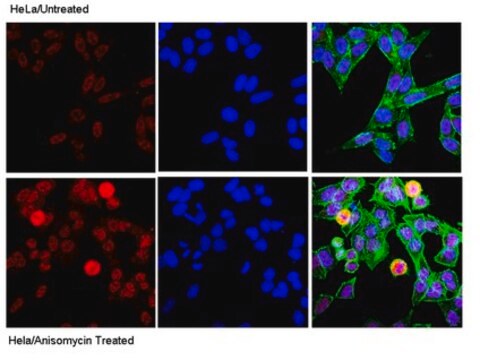 Anti-phospho-c-Jun (Ser73) Antibody Upstate&#174;, from rabbit